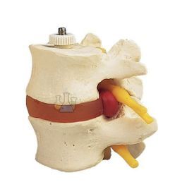 Lumbar vertebrae two pcs